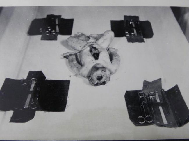 DR. JOZEF MENGELE EXPERIMENT PHOTOS AUSCHWITZ -GRAPHIC : Lot 620105